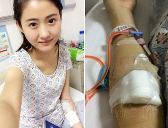 兩年間母親爺爺離世 19歲少女腫瘤晚期笑對病魔