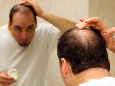 科學(xué)家提取“脫發(fā)克星” 可根治脫發(fā) 脫發(fā)怎么辦？