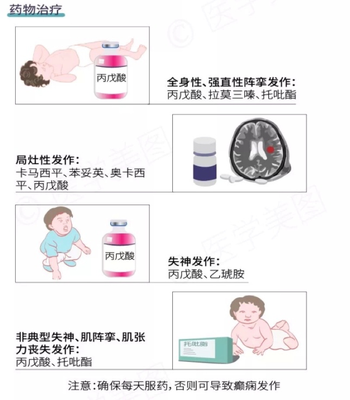  面對(duì)癲癇發(fā)作患者，該如何施以援手？ 