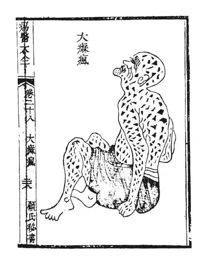 隔離與疾病是如何被污名化的？
