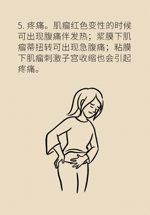 關(guān)于子宮肌瘤，最全的知識在這里