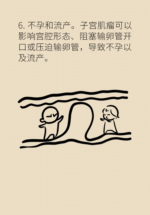 關(guān)于子宮肌瘤，最全的知識在這里