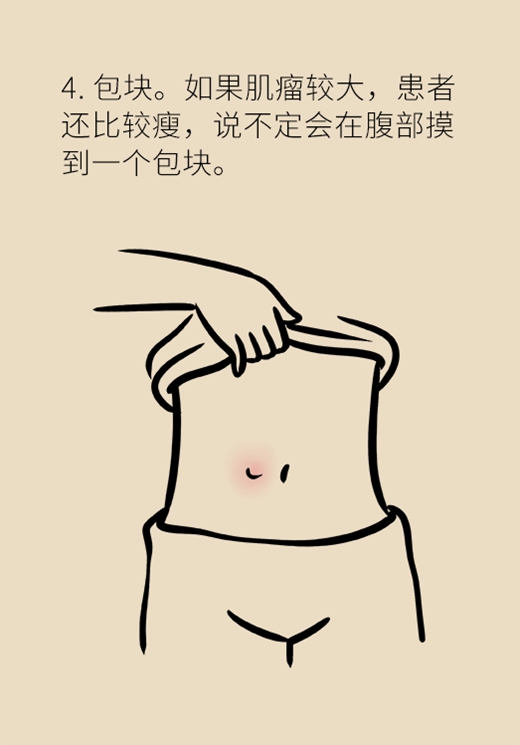 關(guān)于子宮肌瘤，最全的知識在這里