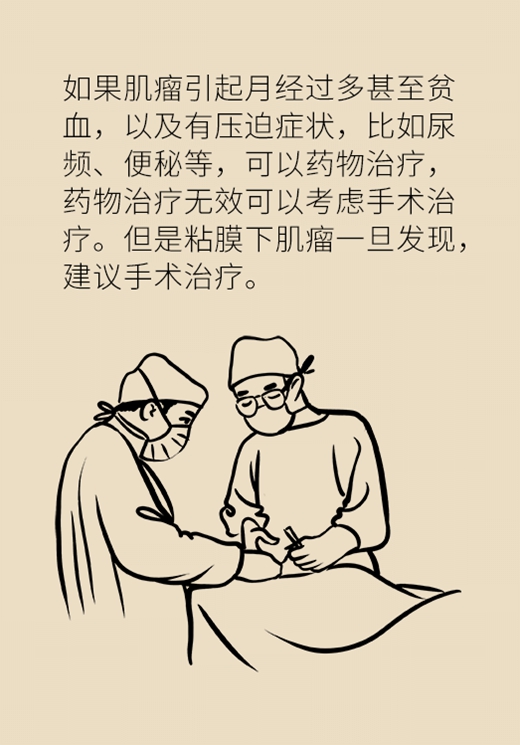 關(guān)于子宮肌瘤，最全的知識在這里