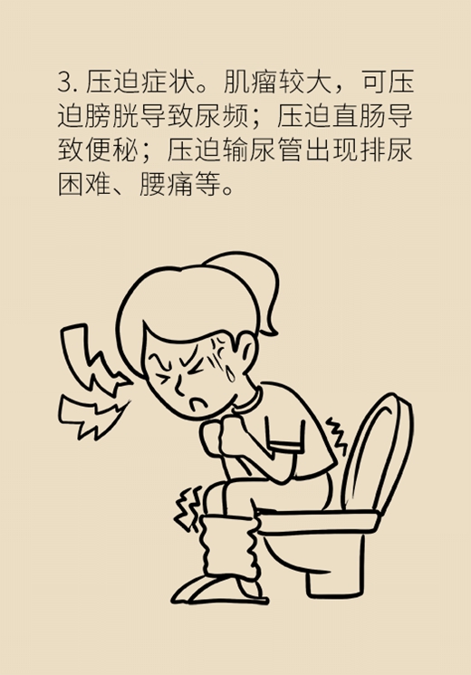 關(guān)于子宮肌瘤，最全的知識在這里