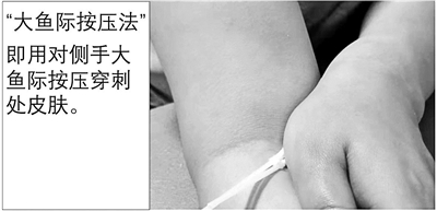 抽血后胳膊一片青是血管細(xì)？多半是你沒(méi)壓對(duì)