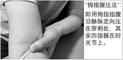 抽血后胳膊一片青是血管細(xì)？多半是你沒(méi)壓對(duì)