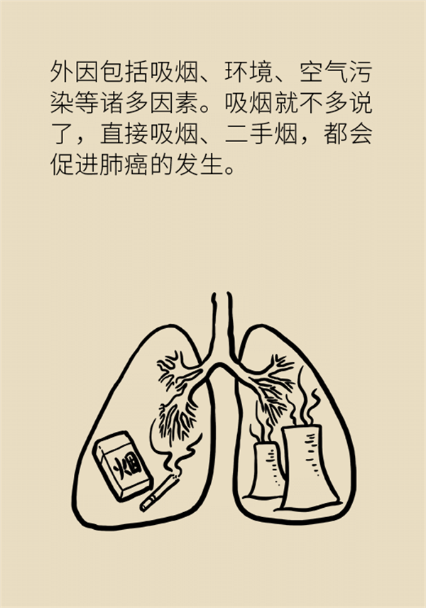 肺部結節(jié)會變成肺癌嗎？這些人群要警惕
