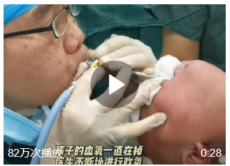 與死神賽跑！#開心果卡進(jìn)寶寶肺醫(yī)生跪地?fù)尵? width=