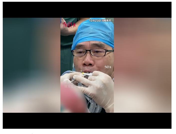 “我快堅(jiān)持不住了！”醫(yī)生為1歲男童吹氧，下一秒……