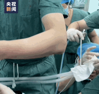 “我快堅(jiān)持不住了！”醫(yī)生為1歲男童吹氧，下一秒……