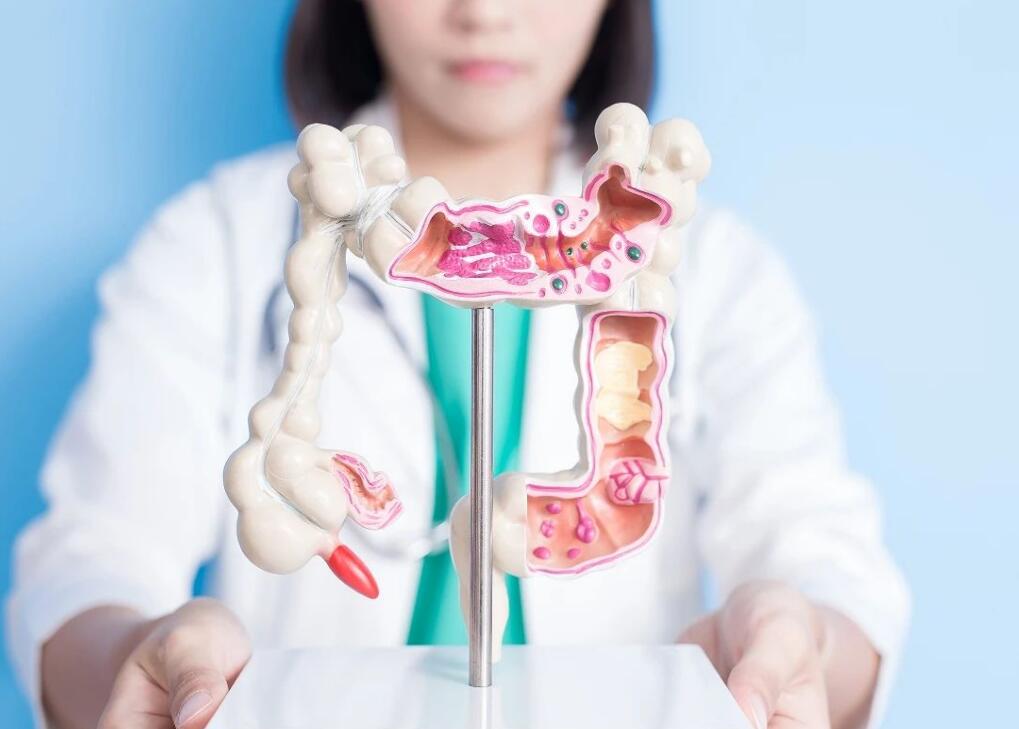 預防早期結(jié)直腸癌 篩查要趁早