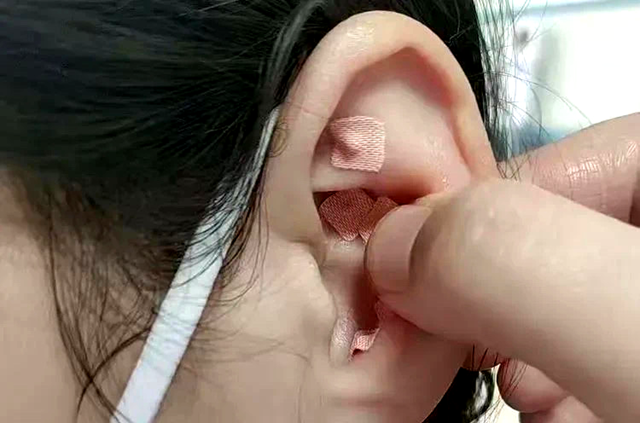 睡眠不好？中醫(yī)耳穴壓豆有妙招
