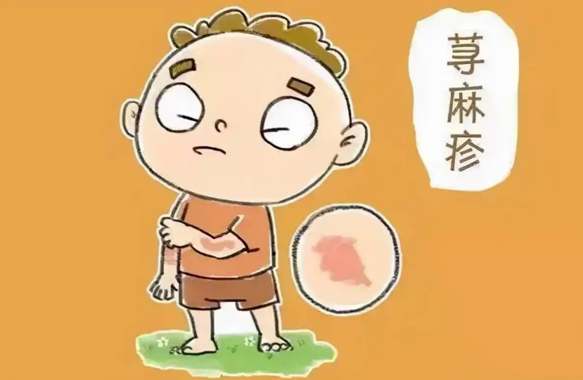 麻疹：你以為它消失了?其實它就在你身邊