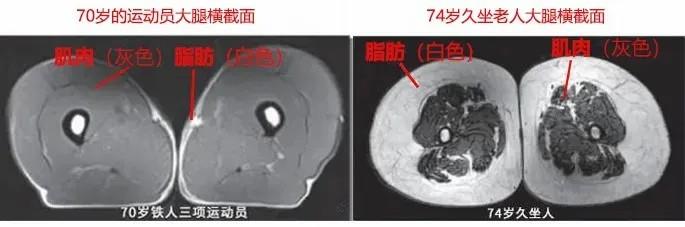 運(yùn)動(dòng)是加速衰老，還是延緩衰老？真相揭開(kāi)
