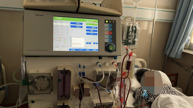  駐馬店市第一人民醫(yī)院成功幫助尿毒癥腦病患者重獲新生