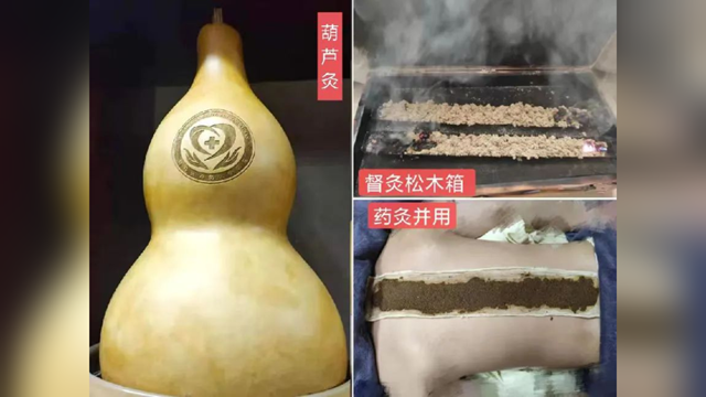 冬病夏治正當時，駐馬店市第二中醫(yī)院即將開展2025三伏貼、三伏灸服務