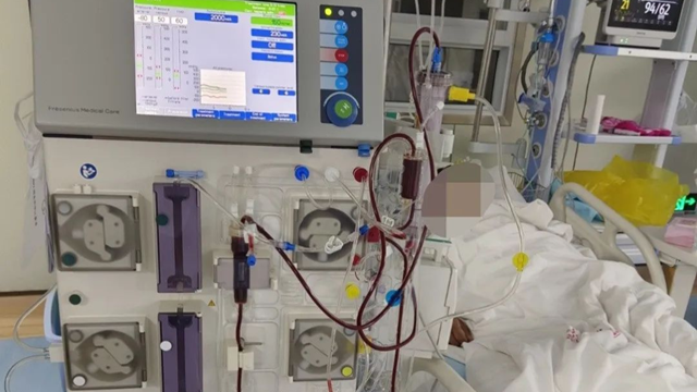  多學(xué)科接力創(chuàng)造生命奇跡——駐馬店市第一人民醫(yī)院成功救治急性腎衰竭合并心力衰竭患者