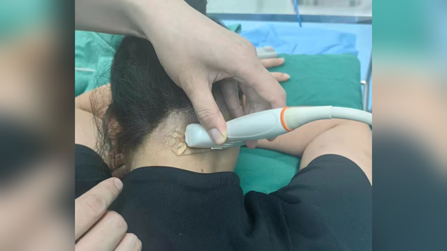 鄭州大學(xué)附屬腦病醫(yī)院（駐馬店市第二人民醫(yī)院）：為破十年偏頭痛，她從廣州來(lái)到駐馬店