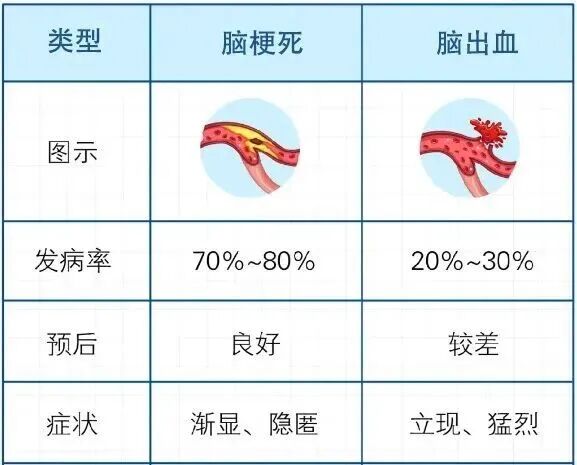 腦梗高發(fā)季到了！有3種不舒服，千萬別大意