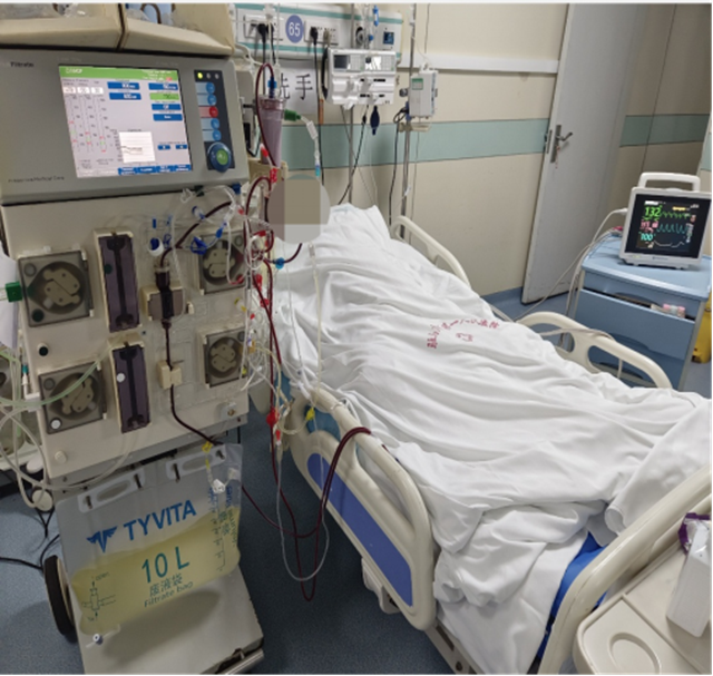 重癥醫(yī)學(xué)科聯(lián)合血液凈化科成功救治腎衰合并心衰患者  床旁連續(xù)血液凈化治療顯威力，危急時(shí)刻守護(hù)生命