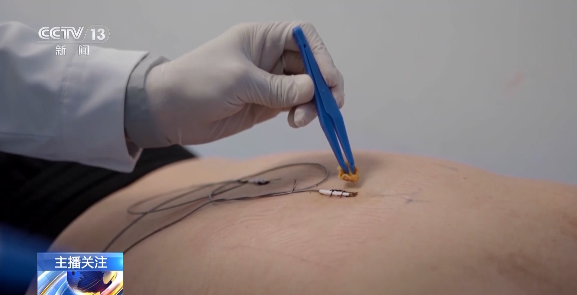 老年人遇到這些身體疼痛勿硬扛 或是健康重要預警信號