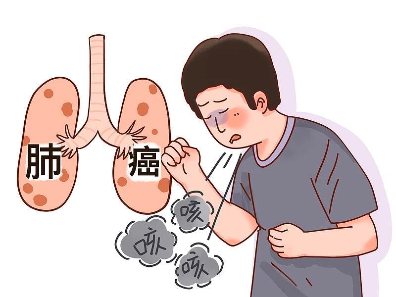 肺癌一發(fā)現(xiàn)就是晚期？身體給出的暗示，不要忽視